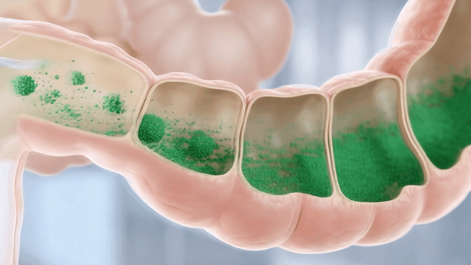 Cross-section of the intestine filling with bright green micronized particles